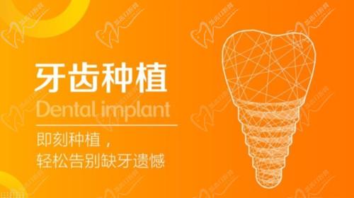 我就说北仑禾睦口腔医院种牙不贵,3000多的种植牙是真实惠