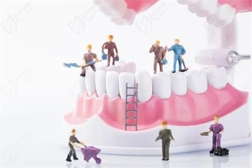 北京钛植口腔种植牙多少钱一颗，奉上钛植种植牙2023价格表及口碑医生