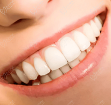 烟台镶牙哪家医院好？查询烟台镶牙口碑好性价比高的医院排名