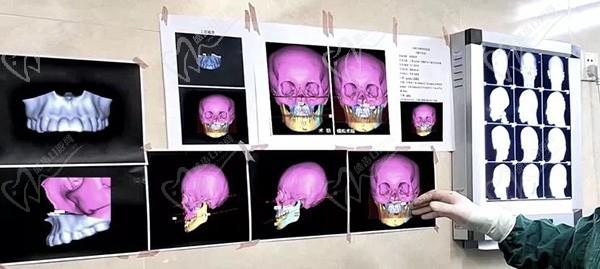 上海时光整形口腔颌面外科拍片