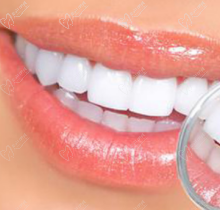 滨州牙博士口腔牙齿矫正价格：金属矫正4k+，隐形矫正1.8w+