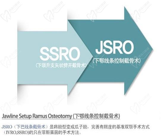 韩国菲斯莱茵整形医院怎么样？双鄂手术在韩国医院排名靠前