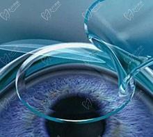 宁波太学眼科医院飞秒怎么样?张丛青院长擅长全飞秒2.5万起