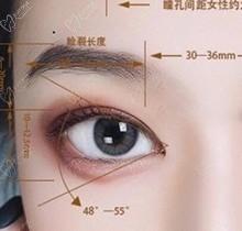 ​北京丽星翼美眼修复中心价格表！魏志香双眼皮眼修复2.8w起-内眼角修复2.3w起