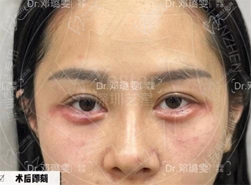 深圳艺星邓璐雯打针蛮好的,气质微整经验多审美也很绝2w起