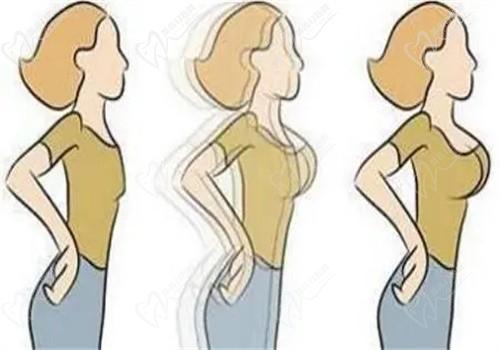 窦玺隆胸手术怎么样?宫廷动感丰胸水平高价格8858起口碑好