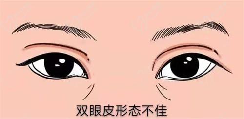 北京丽星翼美可以做各类眼修复,在北京排名靠前很有名气,在线咨询