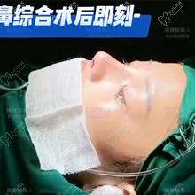 郑州池凯是哪个医院的？坐诊臻颜-专做鼻子医生评价技术好