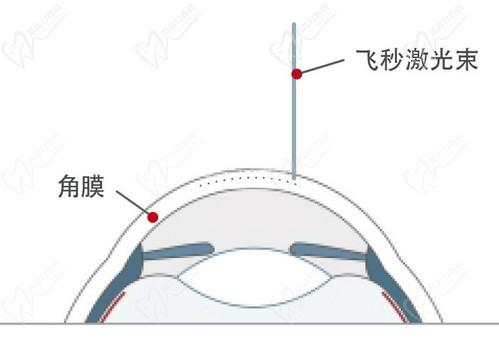 王晓瑛医生在哪里出诊？上海普瑞、上海和平等眼科医院可预约