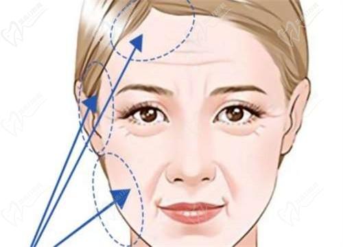 杜太超医生全国排名第几？杜太超排名靠前做拉皮手术口碑技术好