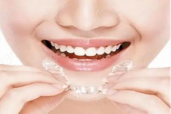 昆明美奥口腔时代天使隐形矫正25800元起，正畸张琳医生技术上线