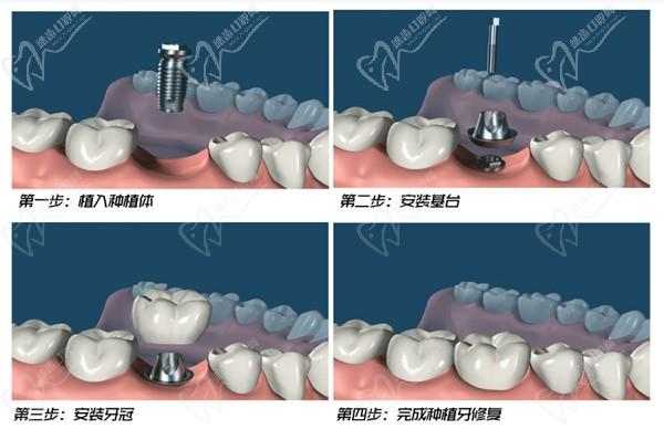 宁德牙先生口腔门诊部电话多少？电话及医院地址送达，附医院特色项目