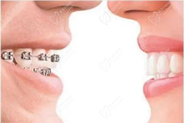 拉萨雅博仕口腔医院董海医生怎么样？看医生简介可见矫正经验多