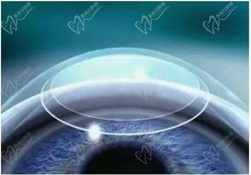 武汉爱尔眼科医院怎么样？正规连锁眼科全科接诊很靠谱