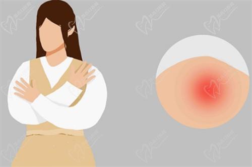 北京周云超异物去除行不行?取出异物干净注射物取出可拨打400-83*-29**预约