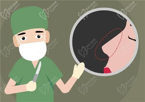 郑州姜南做鼻子经验丰富临床实例3w+，在郑州美莱坐诊在线预约