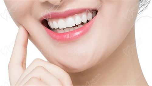 西安小白兔口腔牙贴面多少钱?瓷贴面价格1260+即可享自然持久美白
