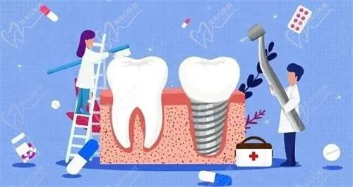 汕头益珺口腔门诊部林秋君高龄老人牙齿种植3031元起，医生技术很不错