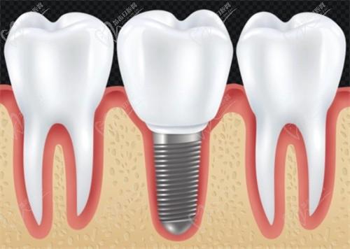 成都西南口腔医院怎么样？正规三级口腔医院，地址电话公布+收费标准！