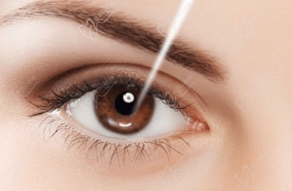 张文凤医生口碑如何？专注近视手术领域技术好坐诊嘉兴爱尔眼科