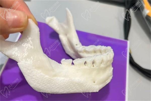 韩国欧佩拉整形医院补骨攻略-macs补骨液做脸不贵附评价地址挂号