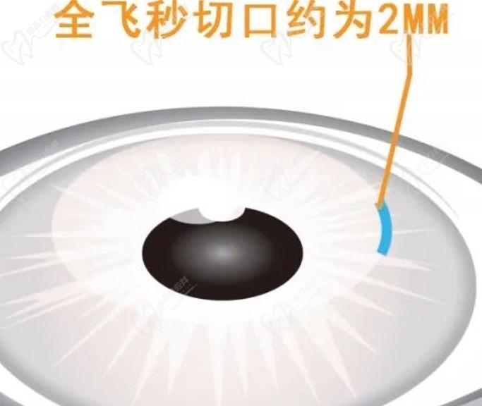 重庆千叶眼科全飞秒手术价格2.08w起，设备高端陈费清近视做的好口碑爆棚