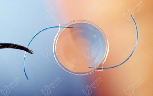 武汉普瑞眼科白内障技术不错，做三焦点人工晶体植入可重返清晰视界