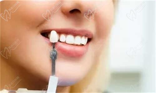 郑州桉康利口腔诊所怎么样？种植牙技术不错，价格透明，值得信赖！