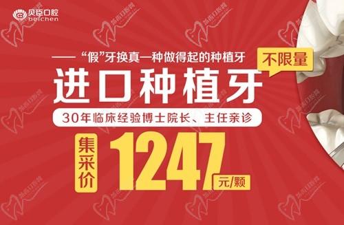 成都贝臣口腔种植牙价格1247-4800元，仕诺康/登腾/ITI可选不限购