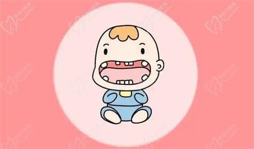 先天性缺牙2颗是比较常见的,揭秘成因、治疗方案及不治疗危害必看