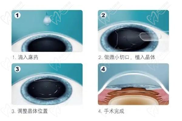 北京安贞医院眼科专家排名：朱思泉、高新晓、郭佳、刘青、洪婷婷上榜快来预约