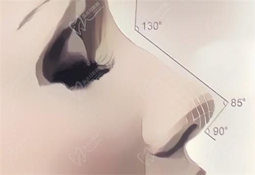 武汉亚韩美容整形医院做鼻子很自然，假体隆鼻、肋骨鼻、注射隆鼻等价格也不高