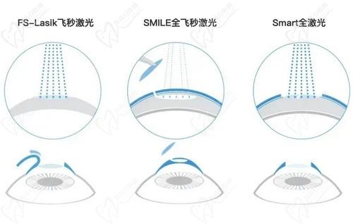 石家庄爱眼眼科魏玲医生擅长做激光近视手术，消除近视拥有清晰的视力