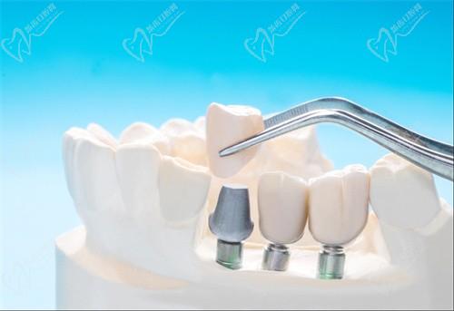 太原爱德口腔门诊部服务超棒技术1流，医师资源丰富正规靠谱附地址