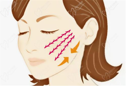 北京四季青橙杨俊拉皮做的好!中下部面部提升价格68000元起可在线预约