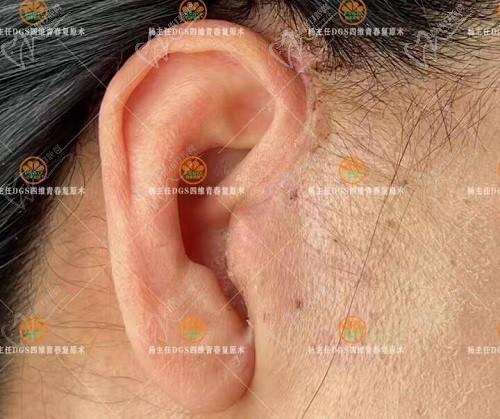 北京四季青橙杨俊拉皮做的好不好?看看杨俊医生在北京口碑和评价