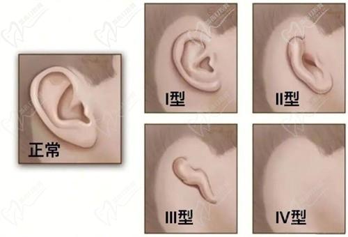 广州高尚余文林,上海戴传昌谁更好的?口碑都很好/收费价格,案例来分析