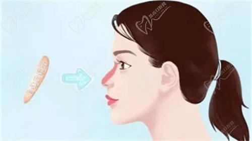 杨水斌医生简介已打包好，坐诊医院_技术优势_隆鼻实例_收费价格_预约挂号等你拿！