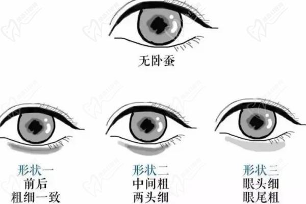 北京鲁礼新做的鼻子和双眼皮好看啊_妈生鼻顾客口碑不错点击就看鲁礼新医生做鼻子医生简介