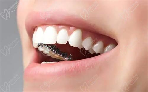 三亚舒诺口腔和拜博口腔哪个好？对比二者实力、口碑和收费助你理性选择！