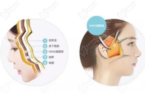 南京朱儒胜医生不只是打针技术好,朱儒胜tcu筋膜提升在南京地区口碑好