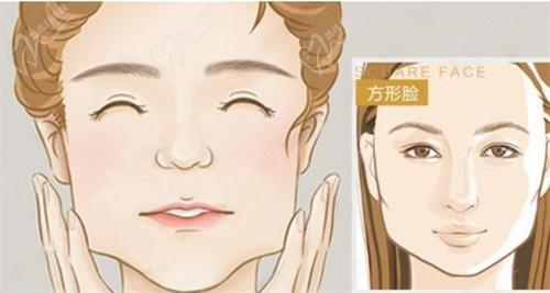 徐威强在广大还是美恩？在广州广大医院做磨骨长期坐诊信息+预约挂号公布！